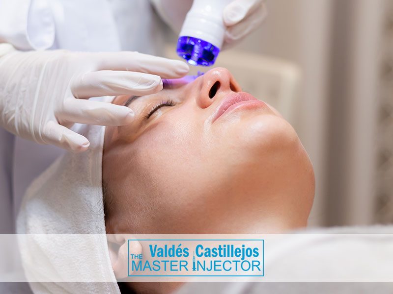 Servicios-Valdes-Castillejos-MESOTERAPIA-FACIAL-Y-CORPORAL